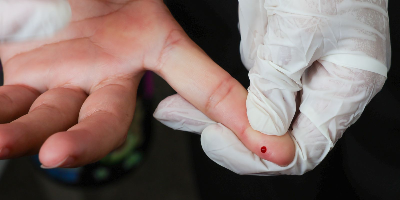 sus-passa-a-oferecer-teste-rapido-de-dengue